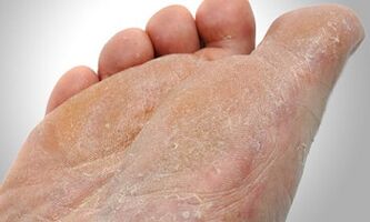 Vías de transmisión de cogomelos de pé